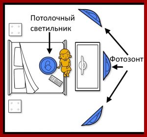 вариант освещения с потолочным светильником и 3 фотозонтами